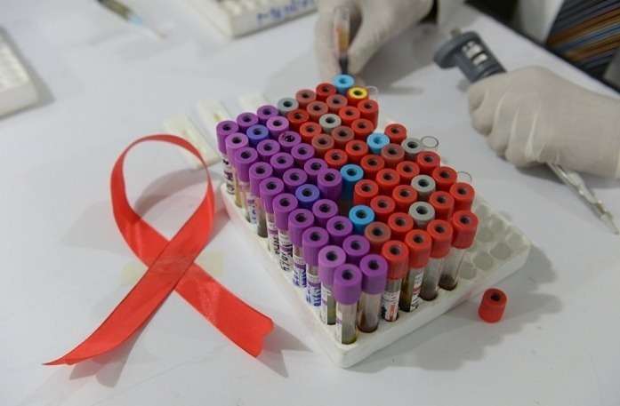 Минздрав: в томском центре по борьбе со СПИДом не хватает врачей и коек