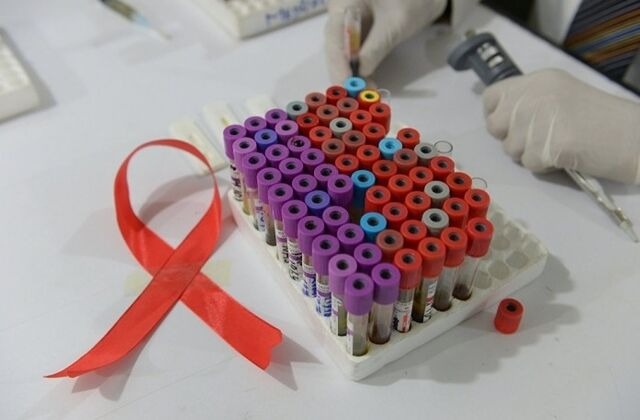 В Томской области  почти вдвое уменьшилось количество впервые выявленных случаев заражений ВИЧ-инфекции